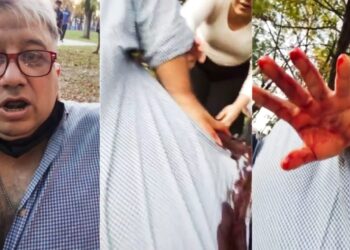 José C Paz: Intentaron robarle la camioneta a un periodista y le pegaron un tiro, se filmó estando herido