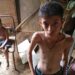 Una persona muere de hambre en el mundo cada cuatro segundos.